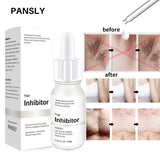 Professional Stop Hair Growth Inhibitor Serum Oil Painless Moisturizing Whitening Removal Non-irritating Skin Care Body Beauty
